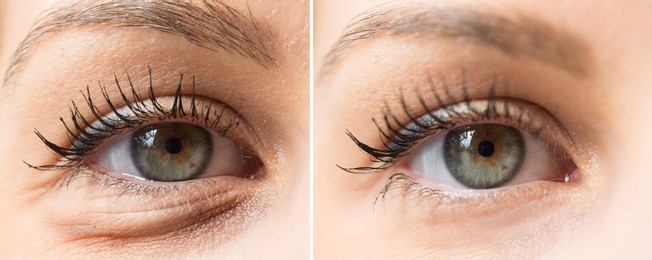 Best Eyelash Extensions in Bangalore